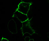 Figure 1: Live HEK293 cells transiently transfected with pSNAP-ADRβ2