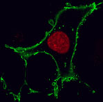 Figure 1: Live HEK293 cells transiently transfected with pSNAP-ADRβ2 and pSNAP-H2B