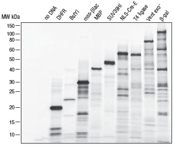 Figure 2: Incorporation of 35S-methionine enables visualizationof protein by autoradiography 